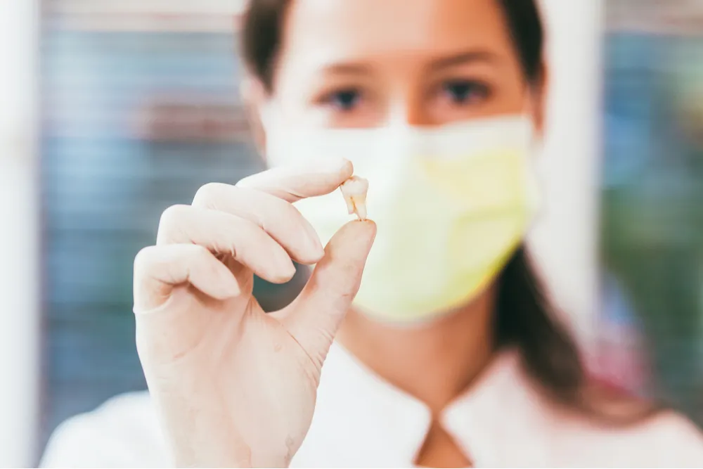 Tooth Extraction