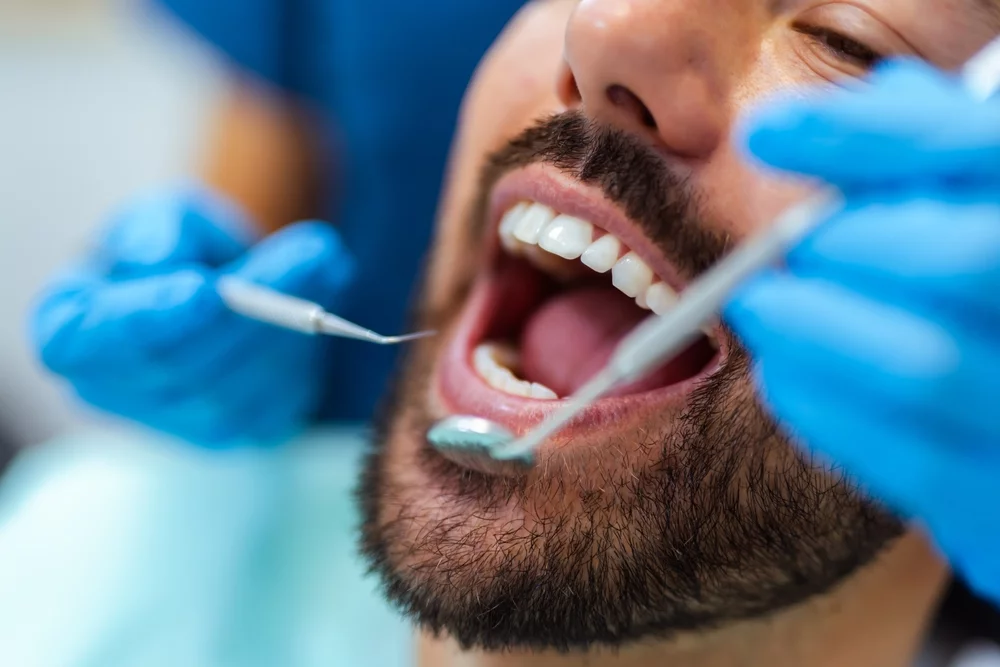 Close-up of a man with open mouth during dental checkup in modern dental clinic. Focus on oral health and dental care.