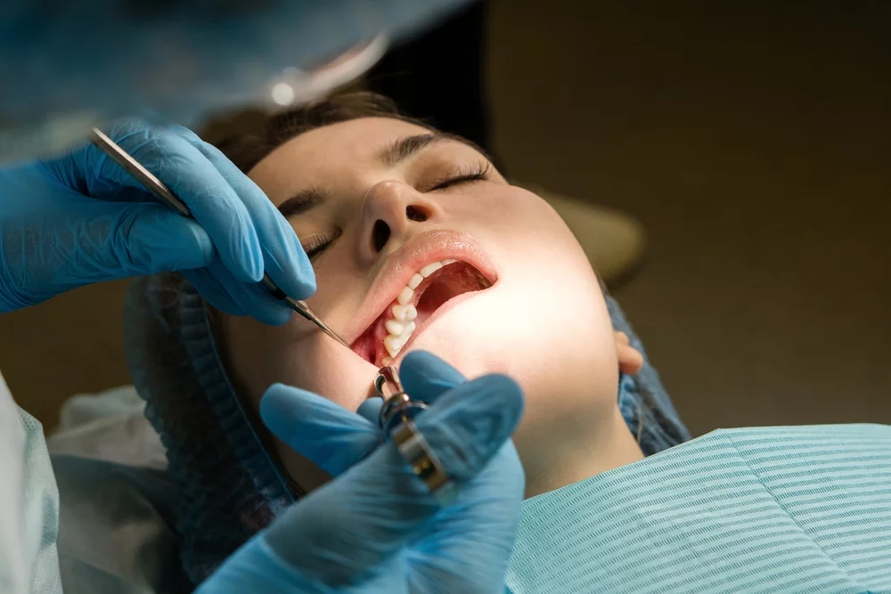 Oral surgeon performs conduction anesthesia with lidocaine using a carpool syringe female patient's mouth before removing wisdom tooth, the maxillary third molar. Real procedure. Close up image